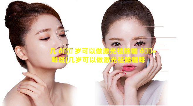 几 🦅 岁可以做激光祛除咖 🌻 啡斑(几岁可以做激光祛除咖啡斑的手术)